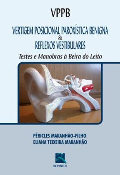 Picture of VPPB - VERTIGEM POSICIONAL PAROXISTICA BENIG. E REFLE. VESTIBULARES